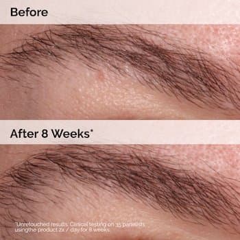 The Ordinary Multi-Peptide Lash and Brow Serum (5ml) | ذا أورديناري سيروم المتعدد الببتيدات لتكثيف الرموش والحواجب - 5 مل